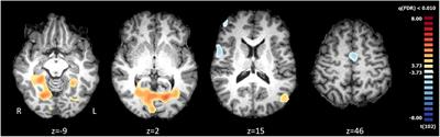 Neural correlates of fanhood: the role of fan identity and team brand strength